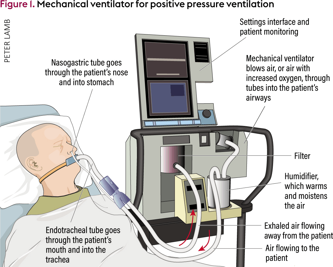 Ventilator