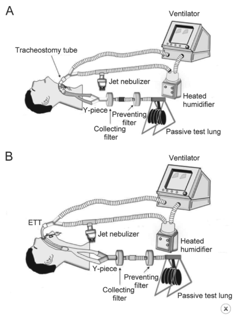 Isihluzo seBakteria eInspiratory